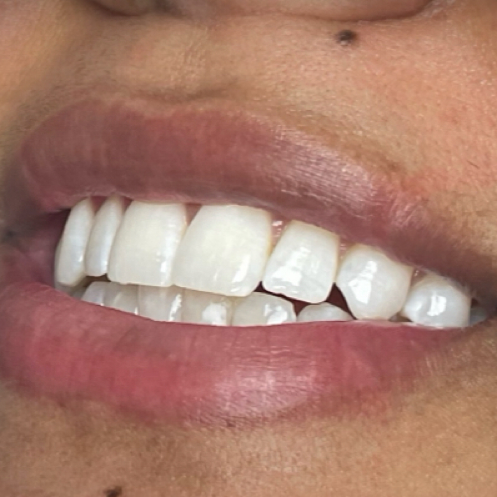 45 Minute Whitening Session at Deeper than Skin in Fayetteville, NC
