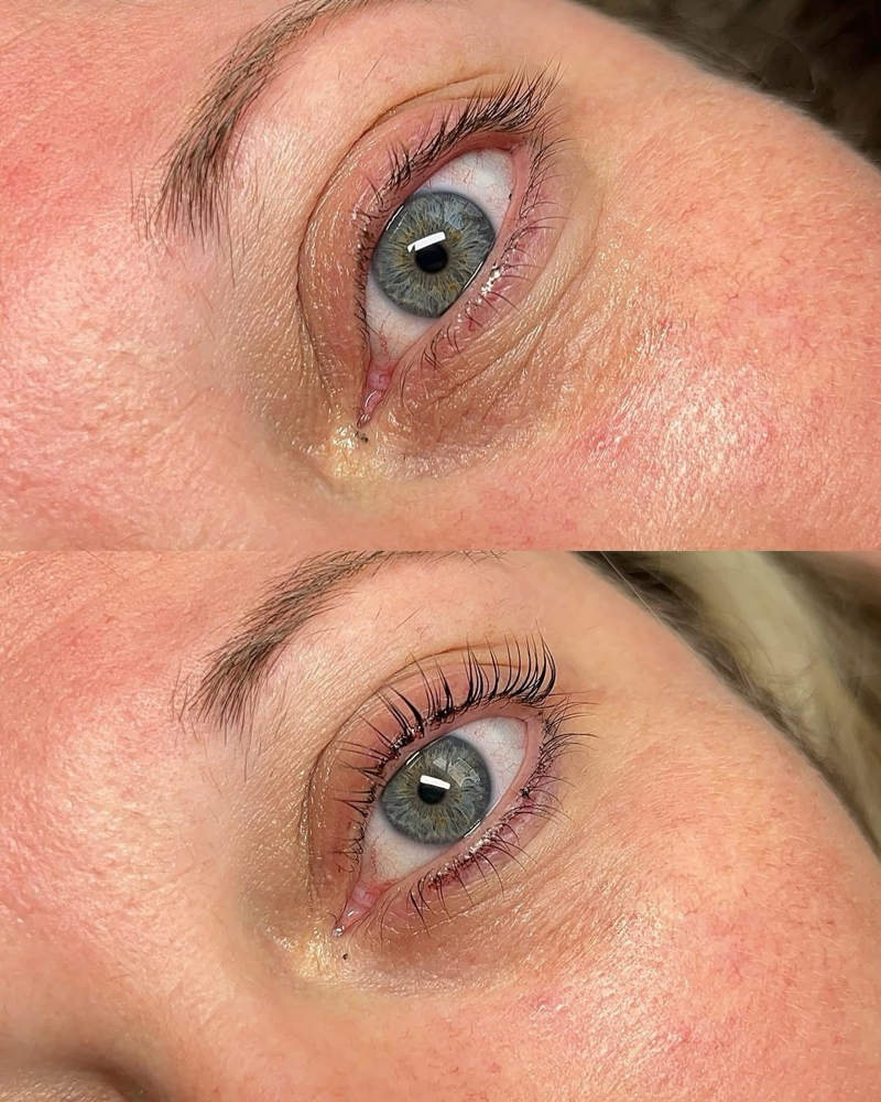 lash lift