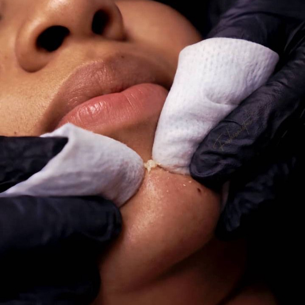 Pore Detox & Extraction Add-On at Cherokee Rose Salon and Spa in Toccoa, GA