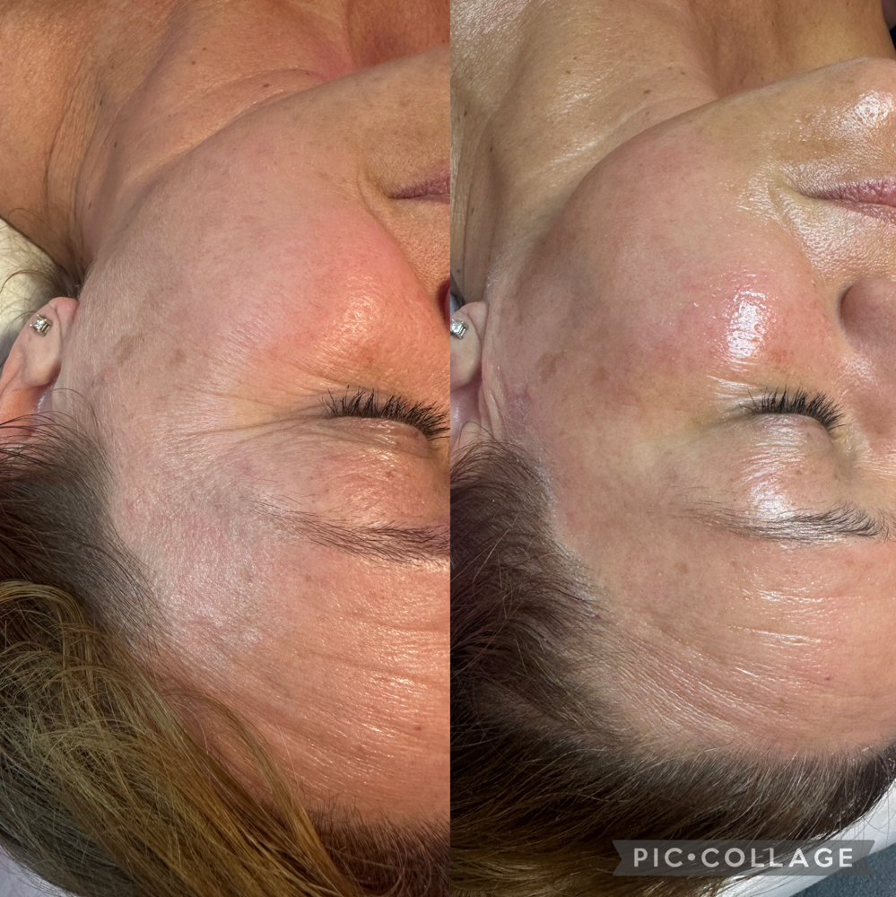 Sammys Signature Facial