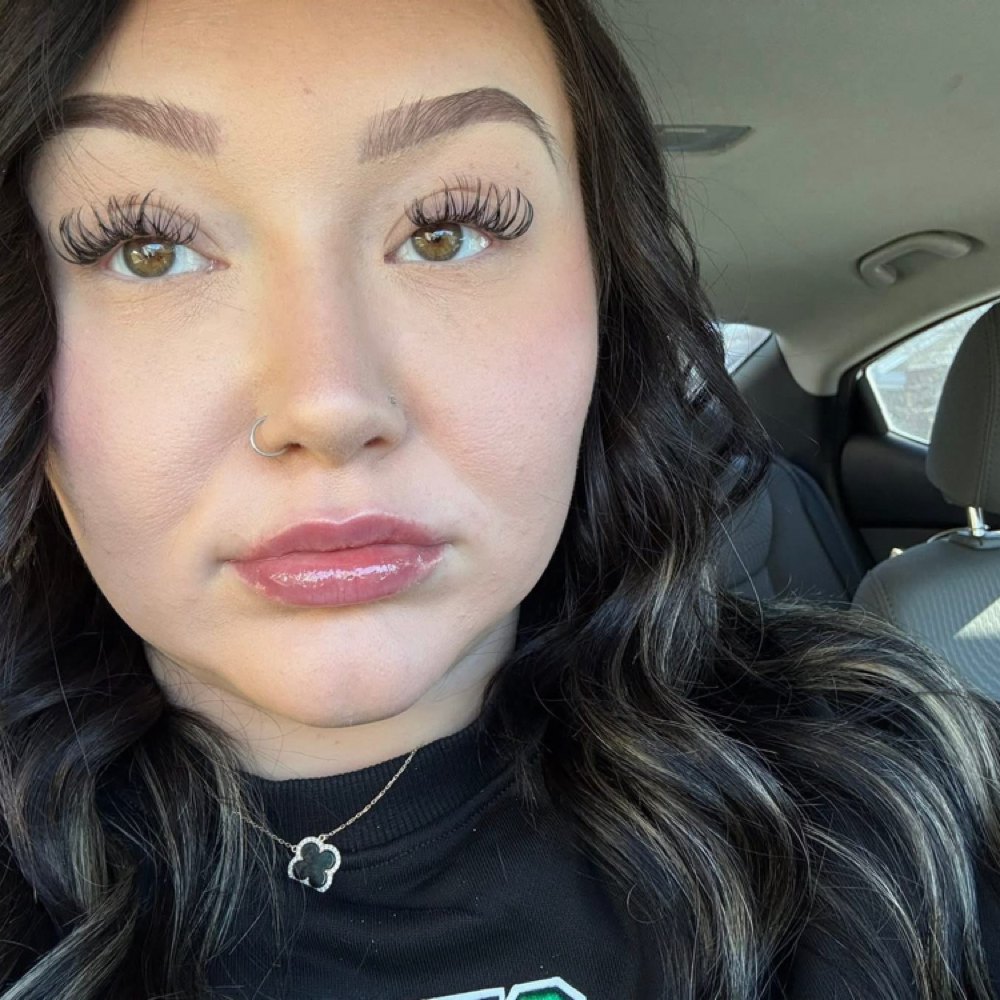 1ML Micro-Needle Lip Filler 💋