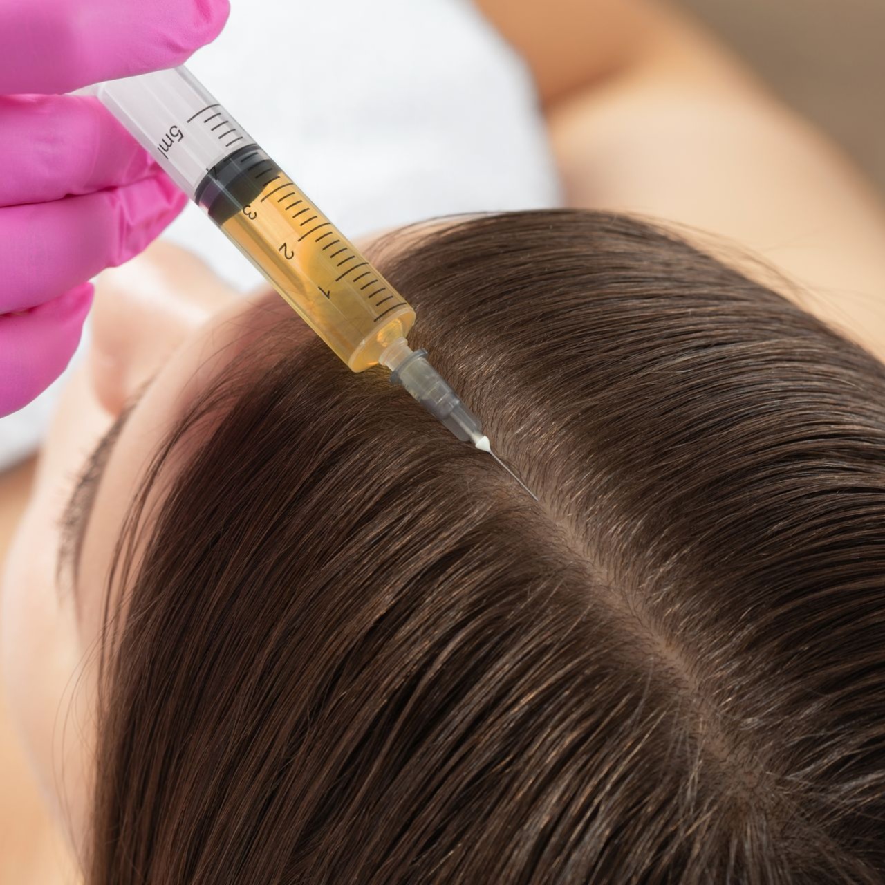 Prp hair restoration at Beleza Medspa in Denton, TX