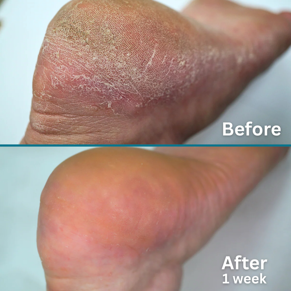 FOOTLOGIX Foot Restoration Pedi at MNB SALONS LLC in San Antonio, TX
