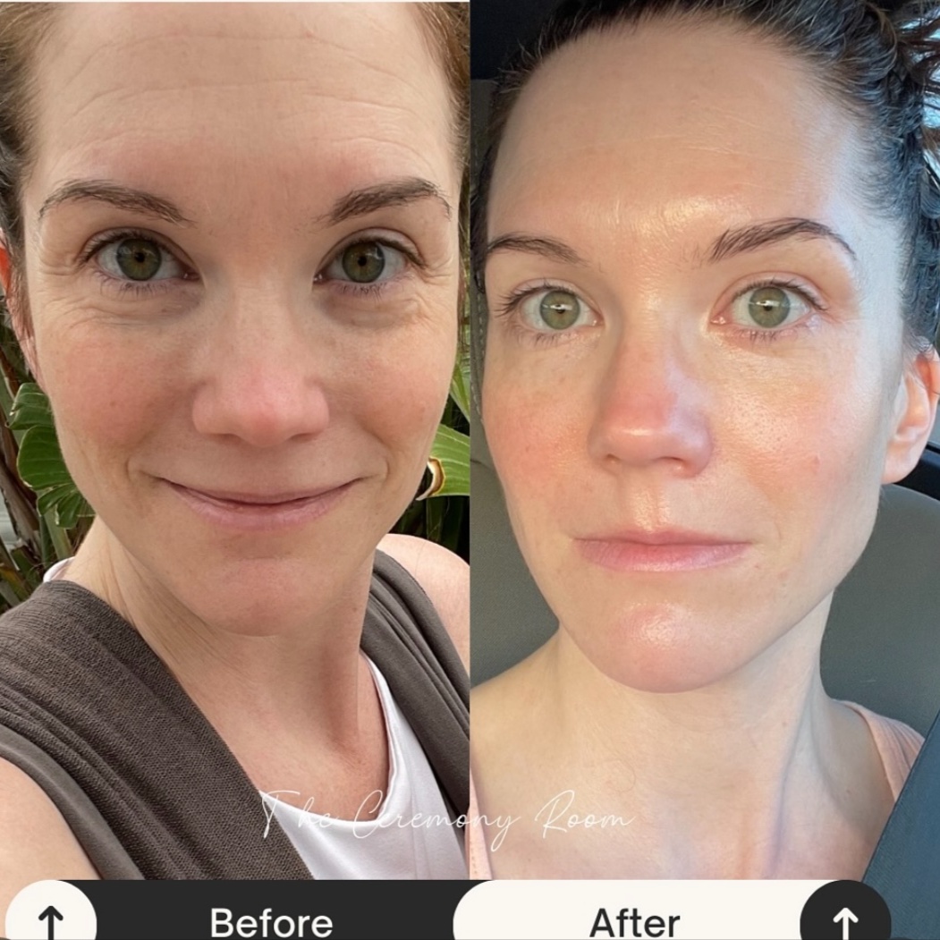 NATURAL FACE LIFT & BUCCAL MASSAGE at The Ceremony Room Organic Facial & Make-up Studio in Saint Augustine, FL