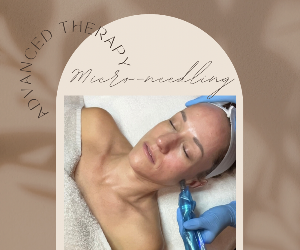 Micro-needling
