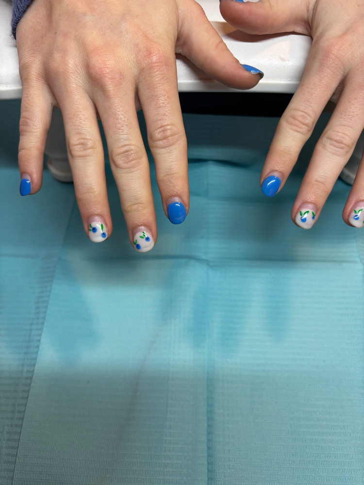 Gel Fill In