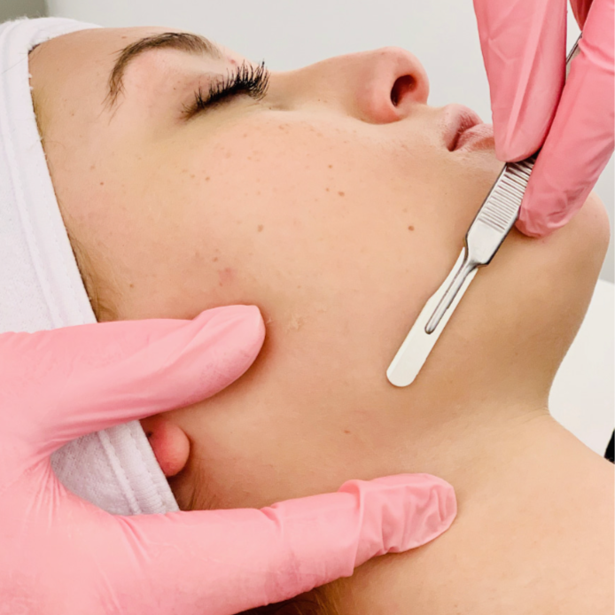 Dermaplane at Tiffany's on Third in Dayton, OH