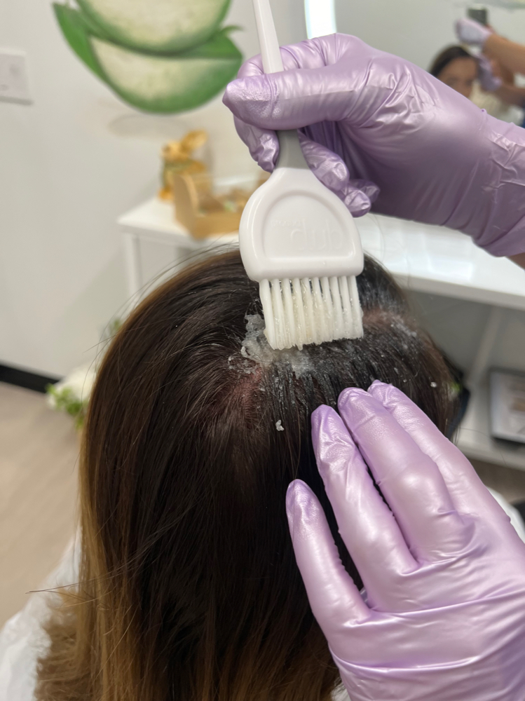 Quick relief for the scalp