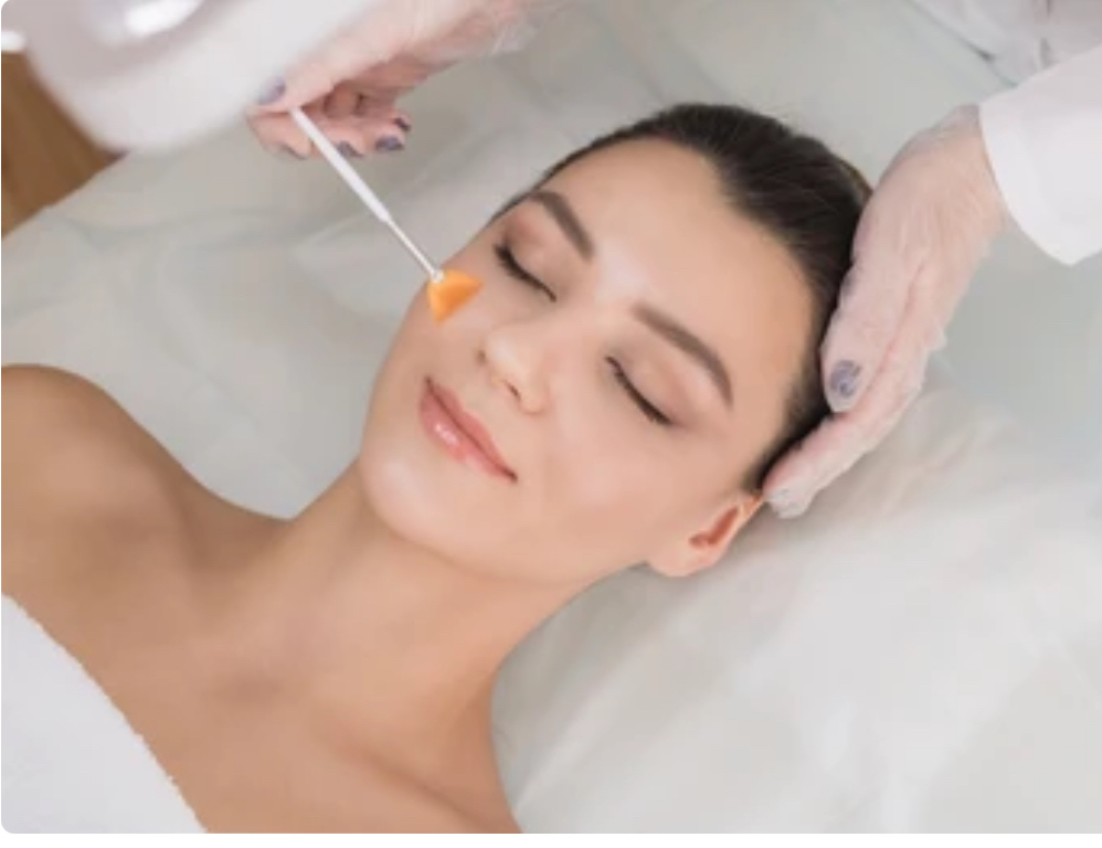 Chemical Peel Facial