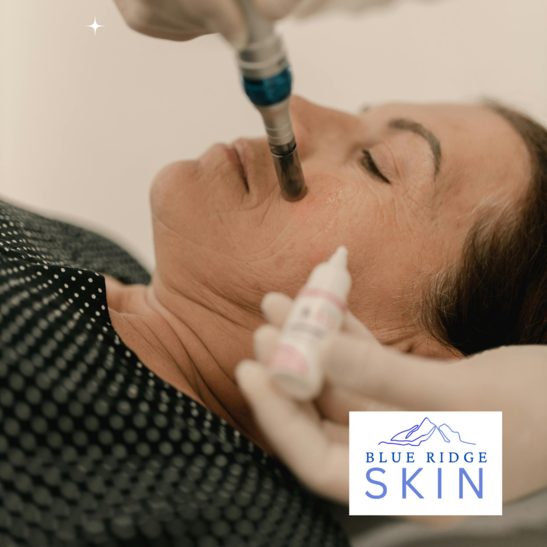 Advanced Facial Treatments at Blue Ridge Skin in staunton, VA