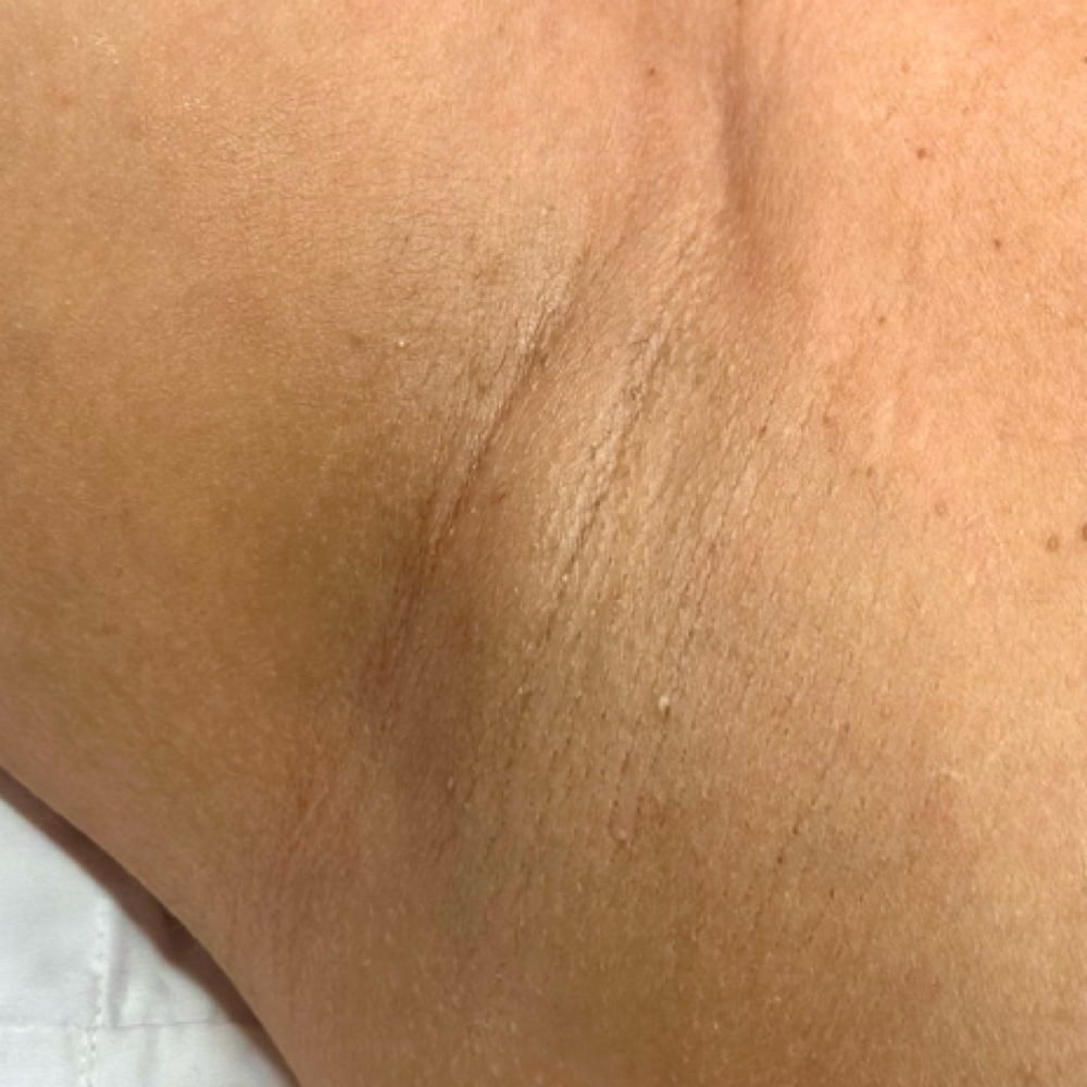 Underarm Wax at Skin Academy in New Bedford, MA