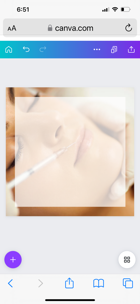 Restylane Lip Filler