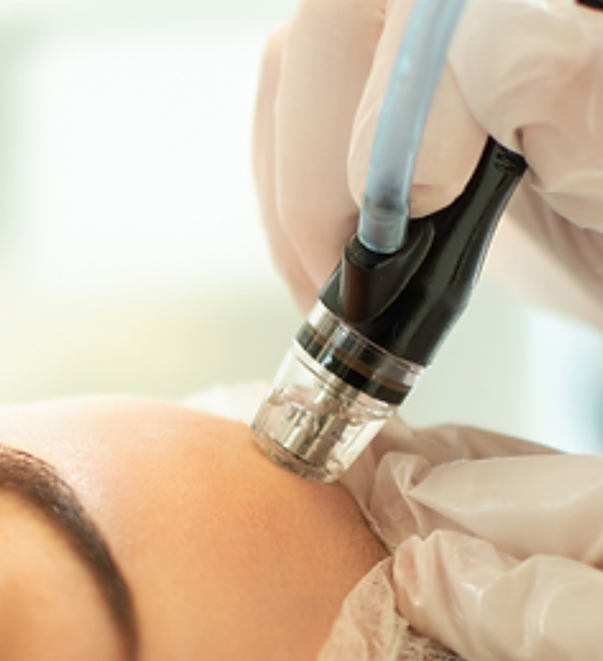 Hydro Glow Facial