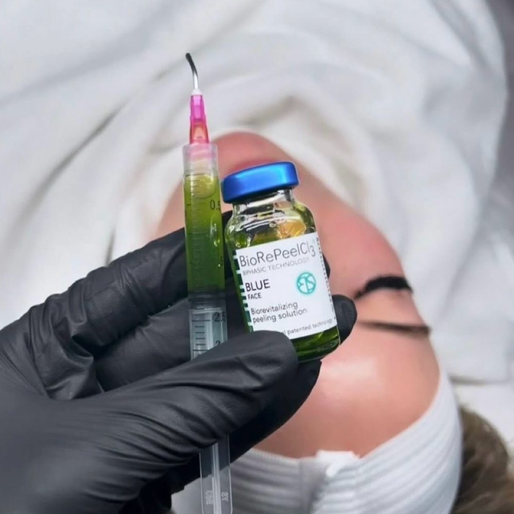 BioRePeel + Microneedling at SKNFORM in Phoenix, AZ
