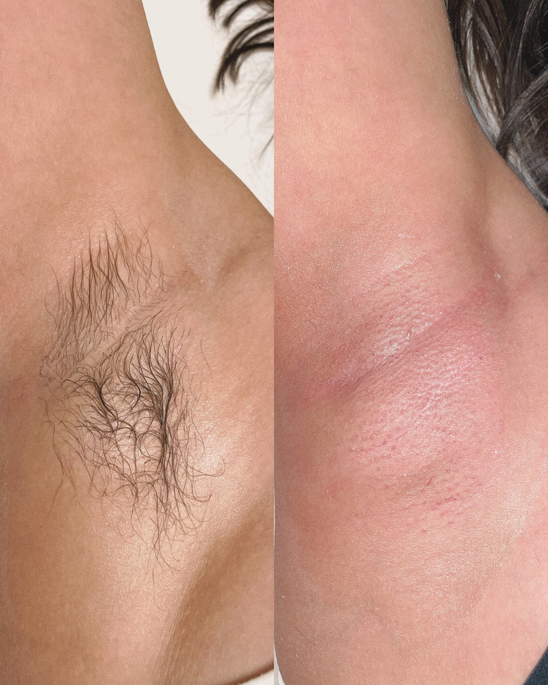 Armpit Wax