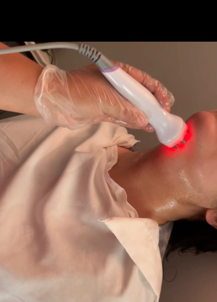 Chin Skin Tightening + Laser Lipo