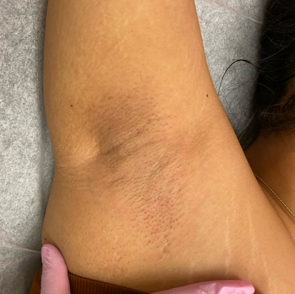 Underarm Wax at Cherry Bloom Beauty in Glendale, AZ