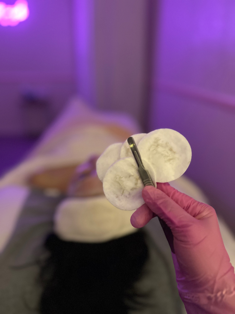Dermaplane Facial