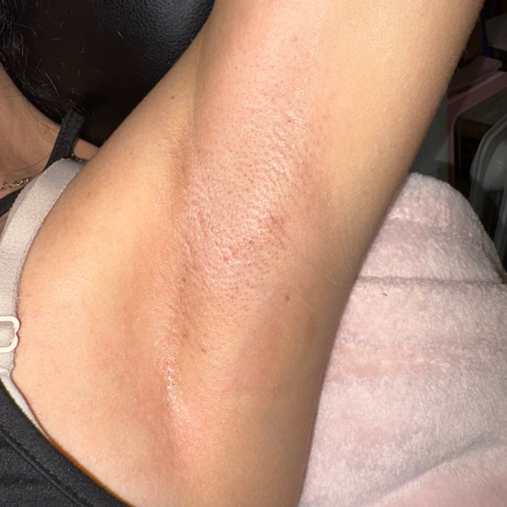 Armpit Wax at Cardi’sbeautyboutique in Winter Haven, FL