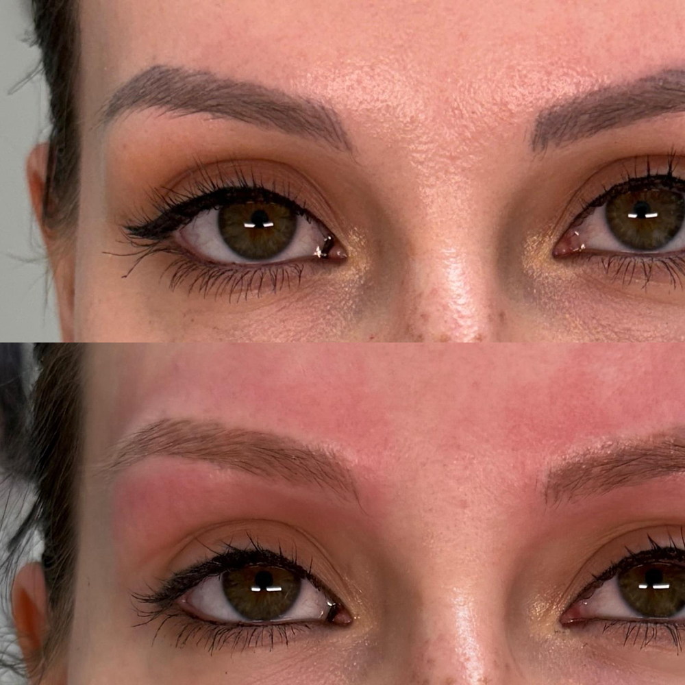 Luxé PMU Tattoo Removal