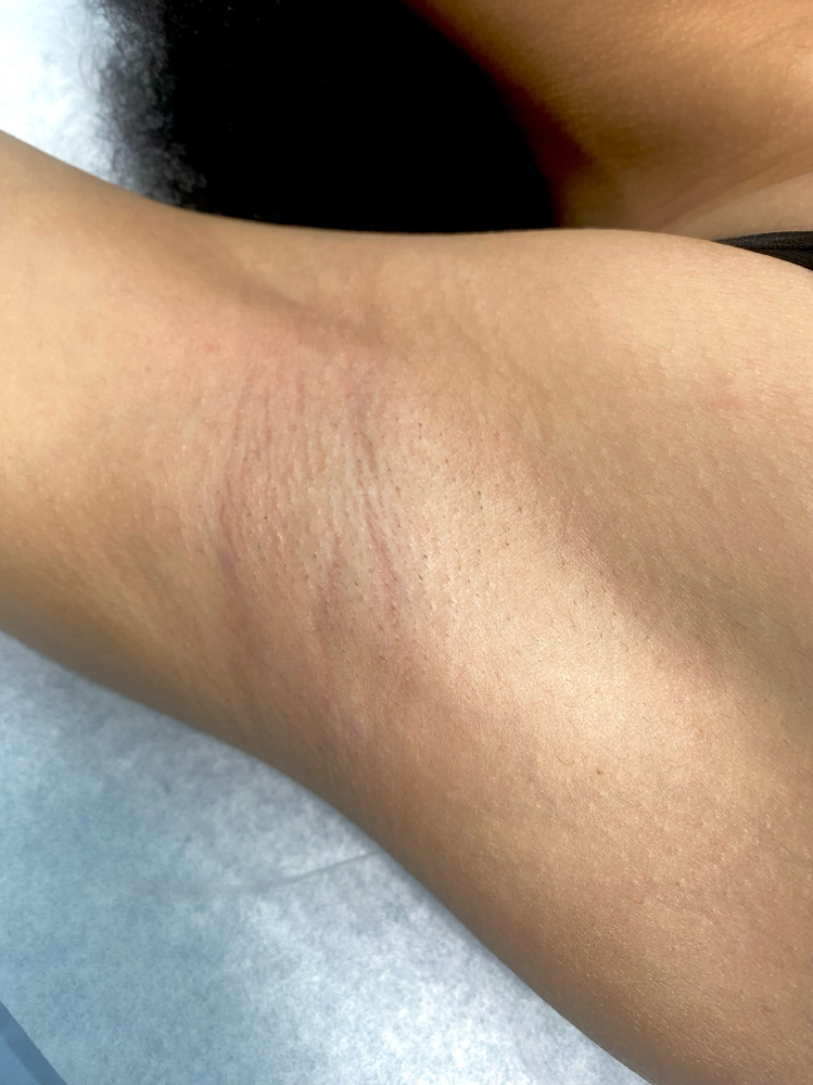 Underarm Wax