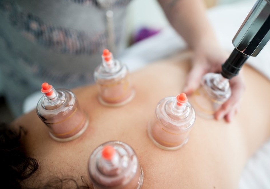 Add On Targeted Cupping Treatment