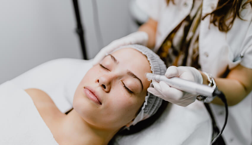 Microneedling