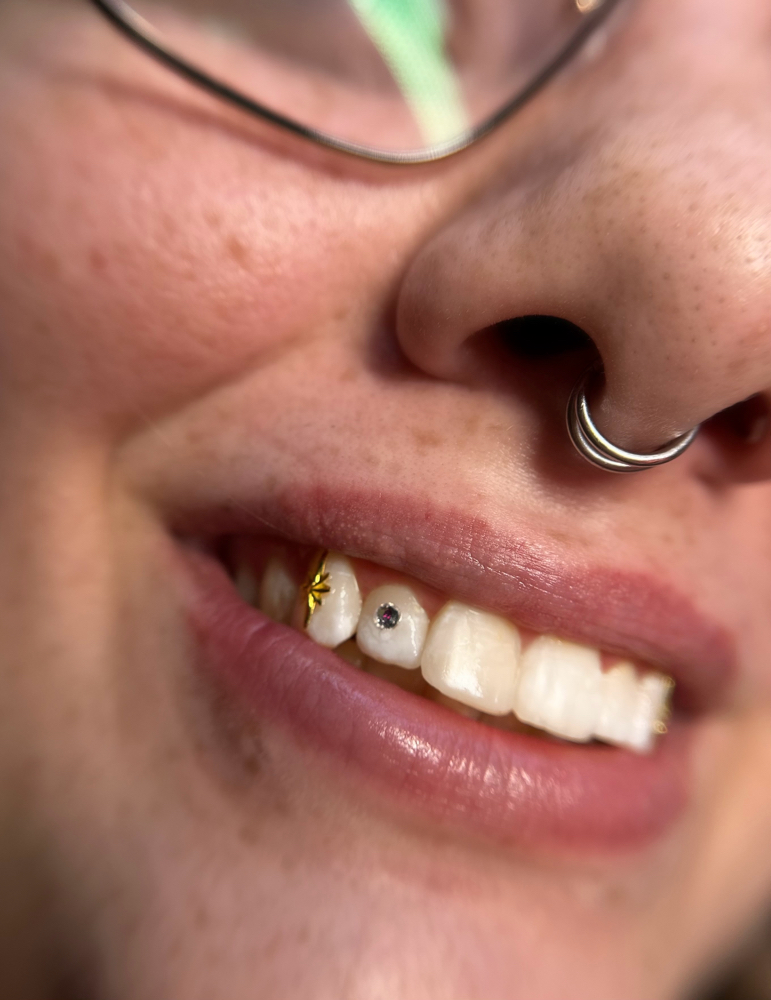 Tooth Gem