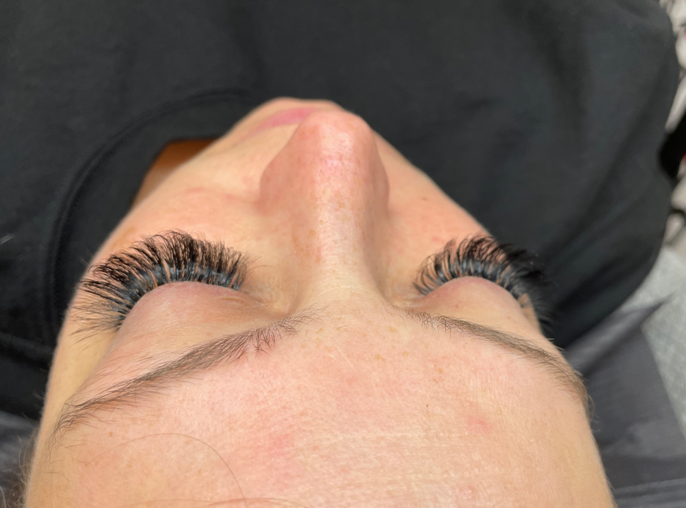 2-3 Weeks FILL *VOLUME*