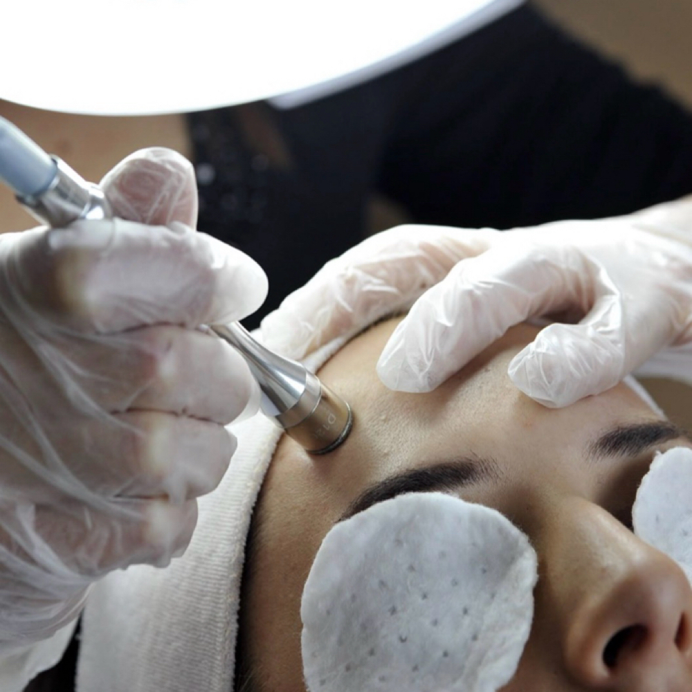 Microdermabrasion Facial at Jaycie.The.Esti in Abilene, TX