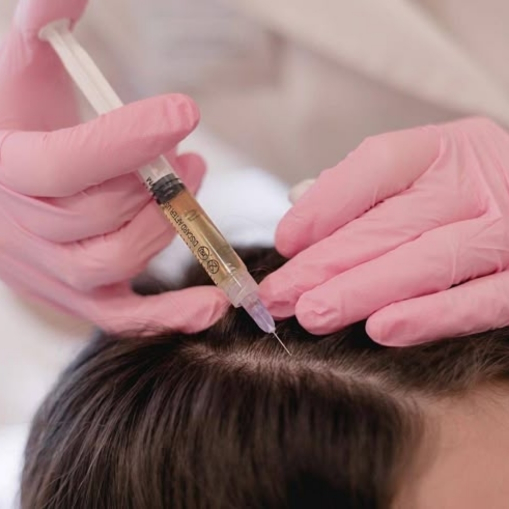 Plasma Power Regrowth at D'Yalorde Wellness & Aesthetics LLC in El Paso, TX