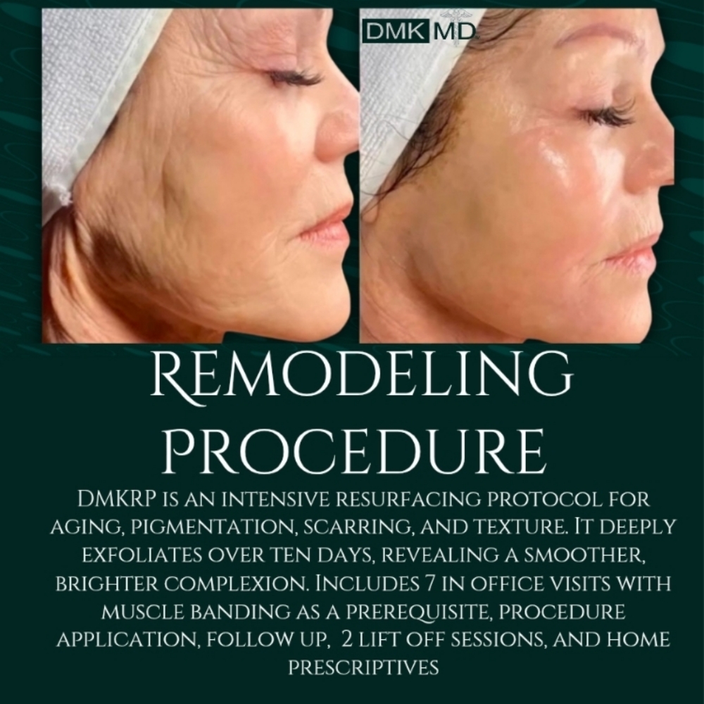 Remodeling Procedure Consultation