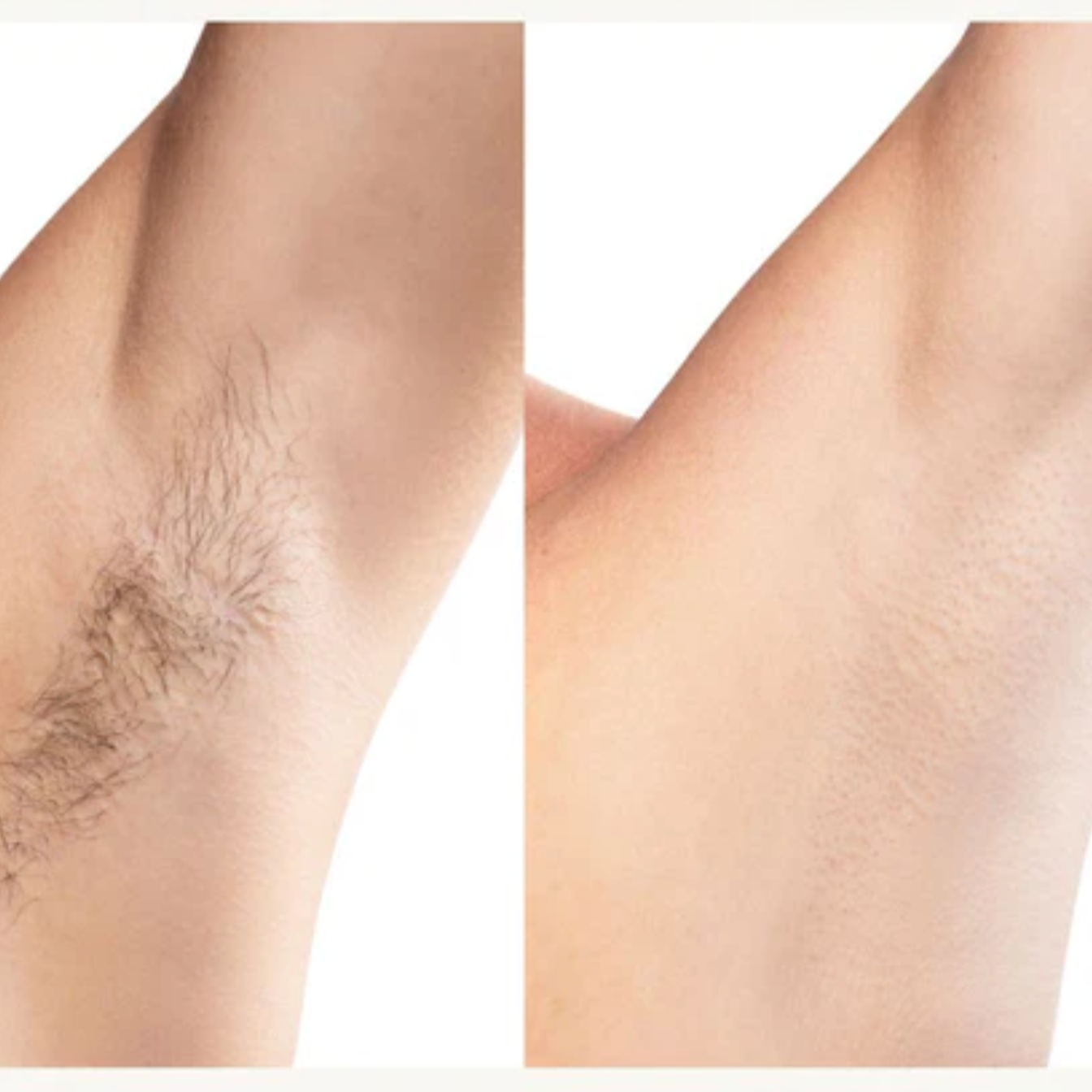 Underarm Wax at Sassy B Salon & Spa, Fire Pit Tattoos & Beyond the Lines in East Bank, WV
