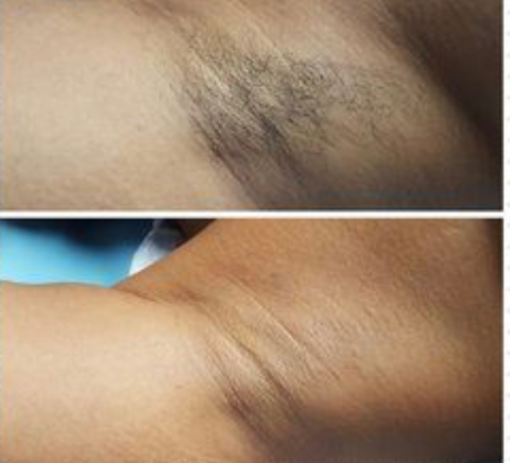 Underarm wax at Lavishminksandbeauty in Columbus, GA