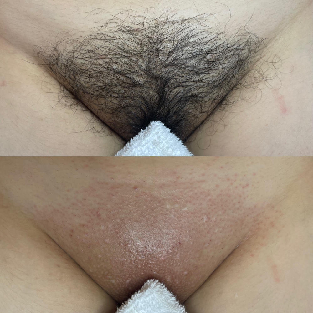 New Client Brazilian Wax at Pink Crab Wax Bar in Las Vegas, NV