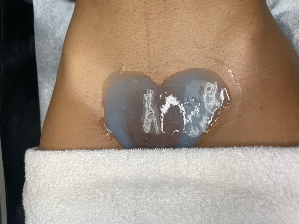Brazillan + Hydrojelly Mask
