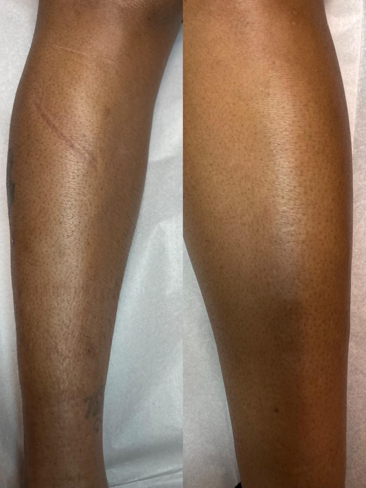 Leg Wax (half)