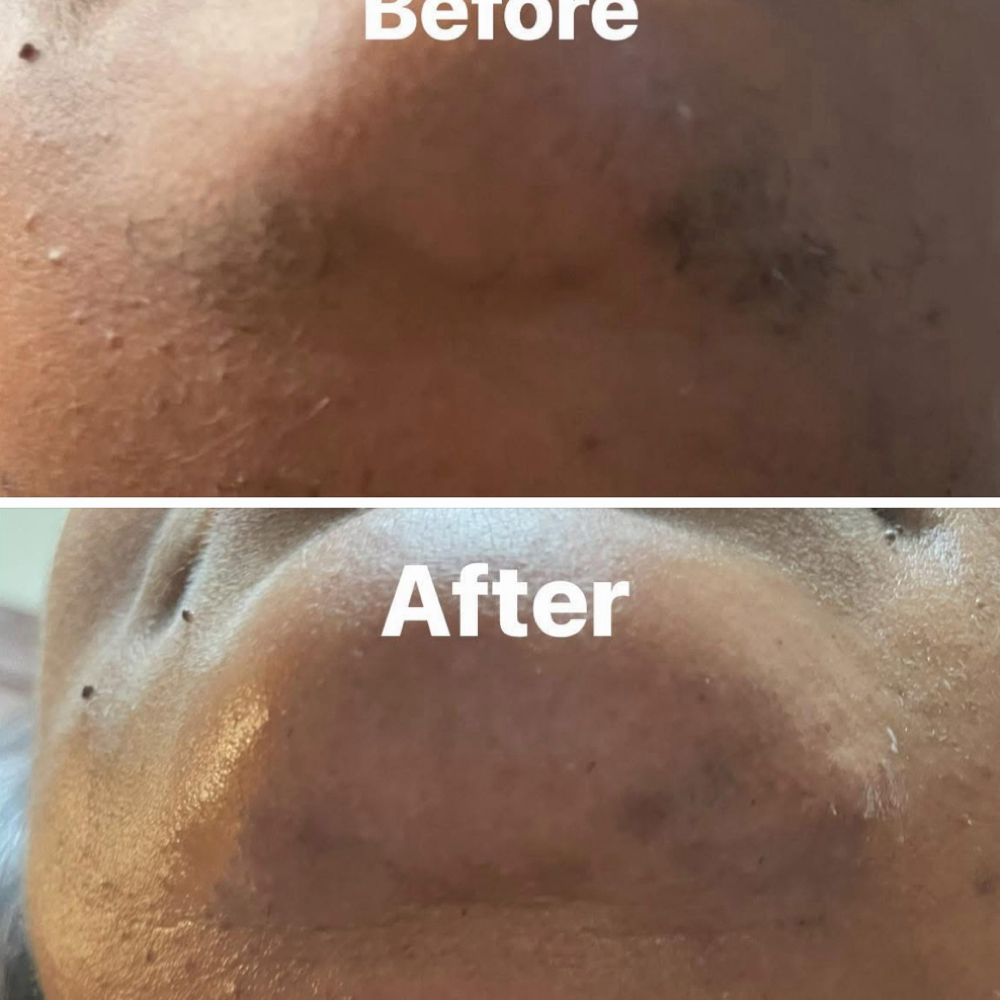 Chin Wax at Tekila’s Timeless Touch in Flint, MI