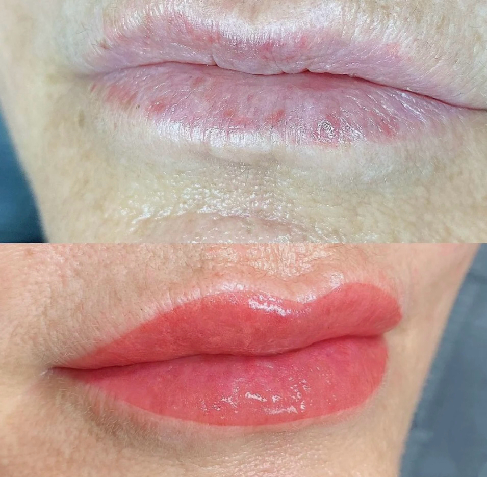 Lip Blushing