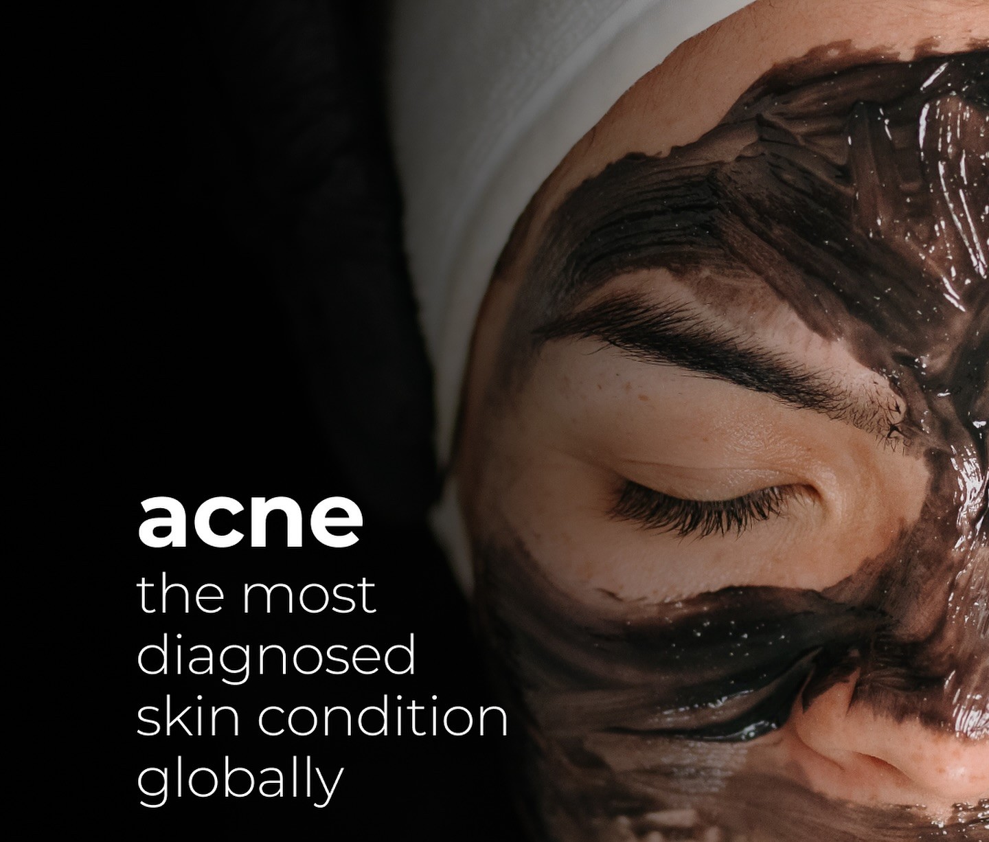 Acne Clarifying Facial