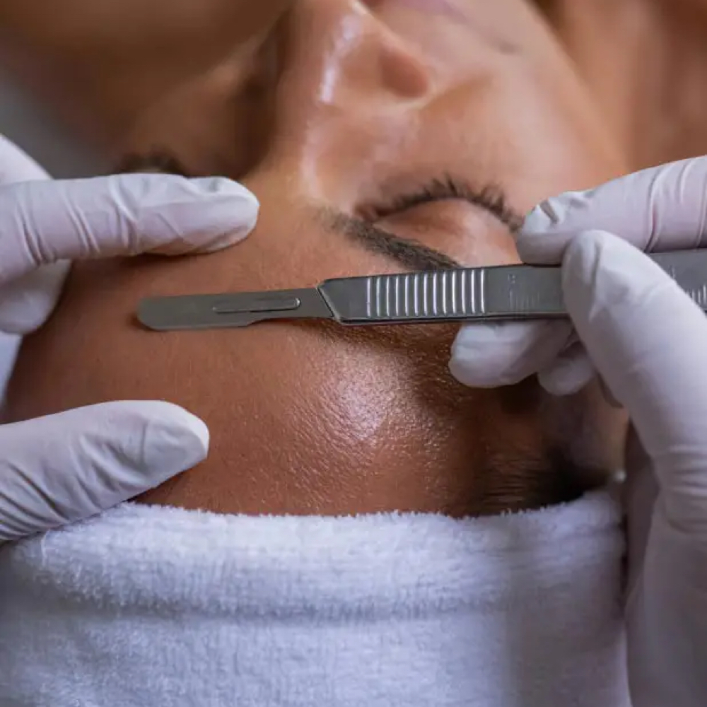 Dermaplaning at The Boujee Beauty in Burnet, TX