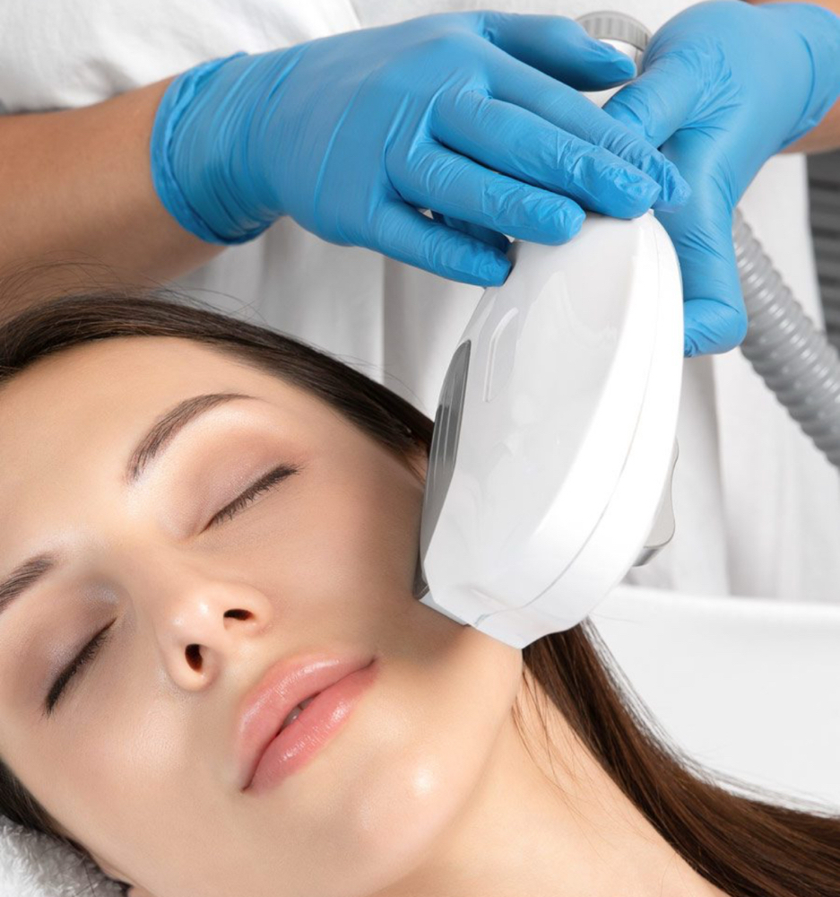 Intense Pulsed Light (IPL) Treatment