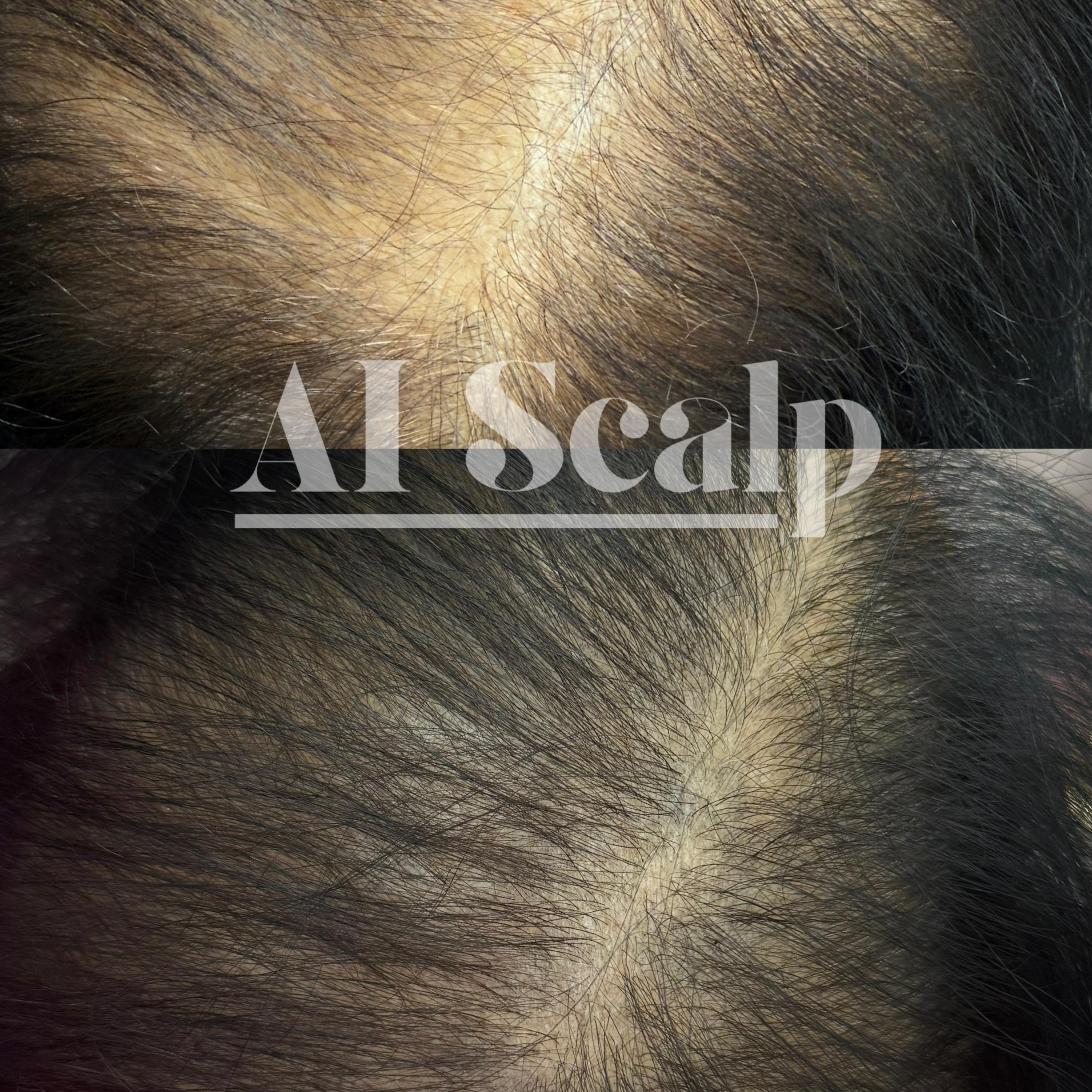 Ai Scalp - 3pk/1 zone at Alchemy Haus by Devyn | Color. Extensions. Scalp Density. in Atlanta, GA