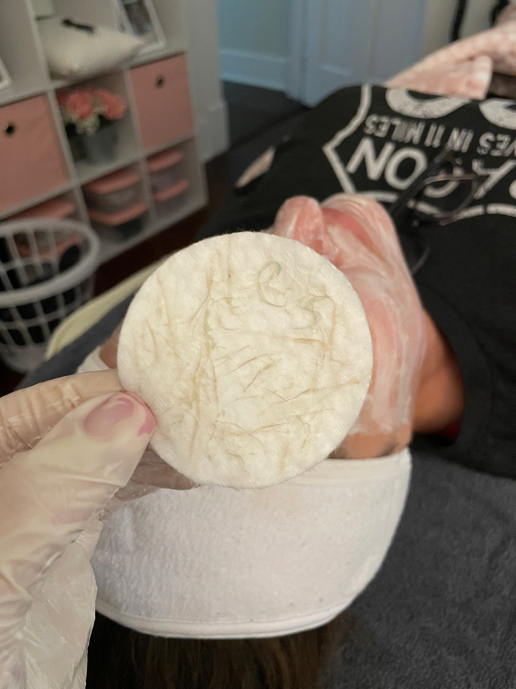 Dermaplaning Facial