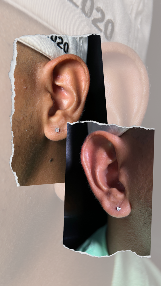 Ear lobe pair