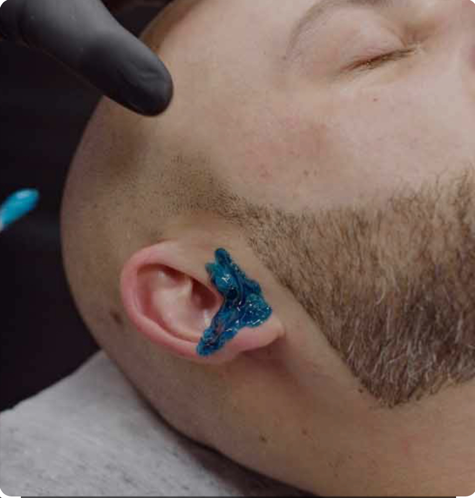 Male Ear Waxing