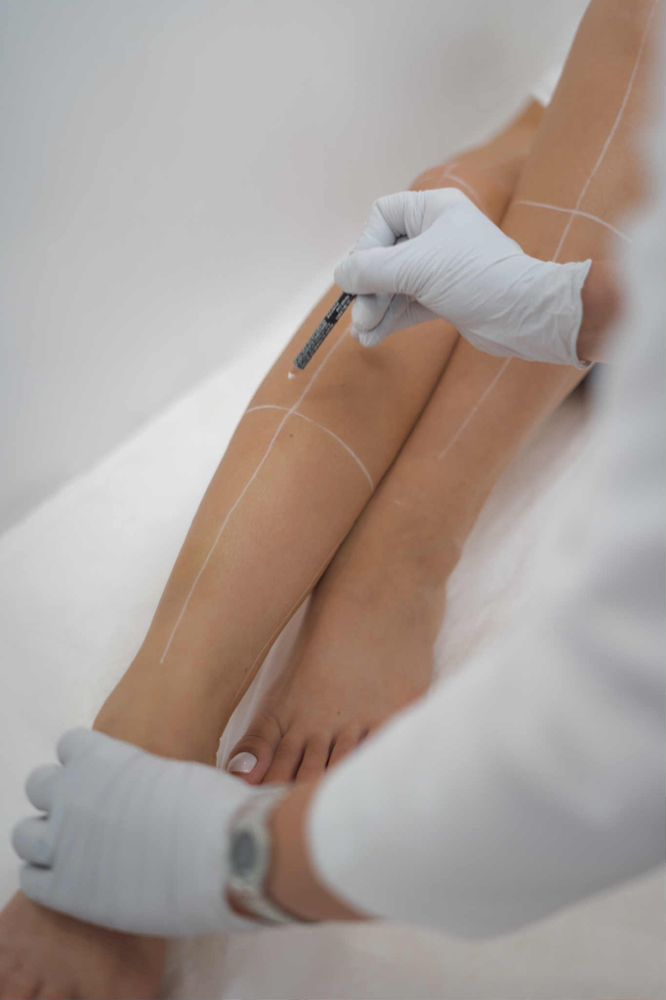 Woman Full Legs at Maiko Aesthetics in Brooklyn, NY
