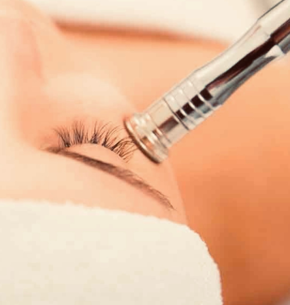 Microdermabrasion Treatment