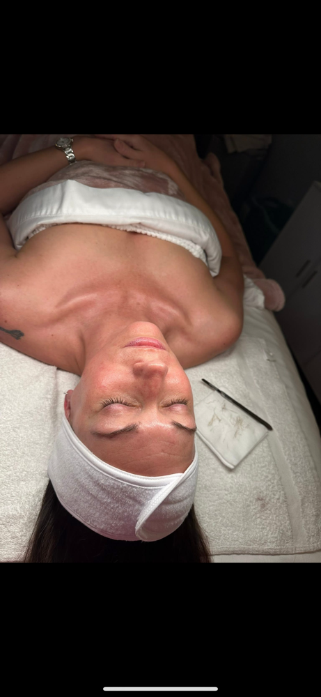 Dermaplanning