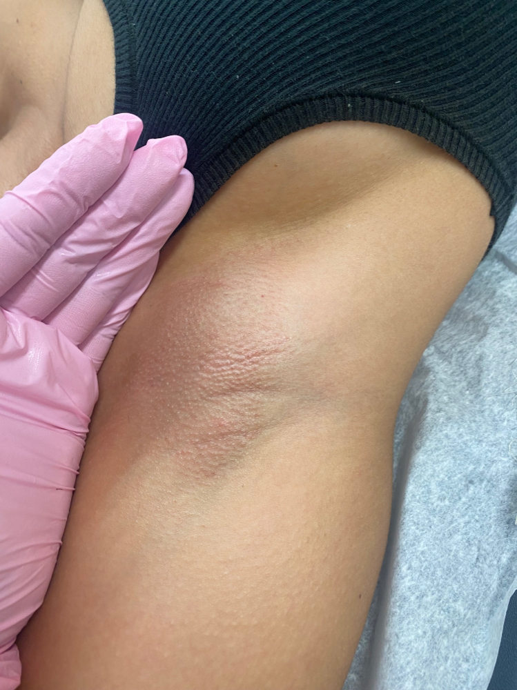 underarm wax